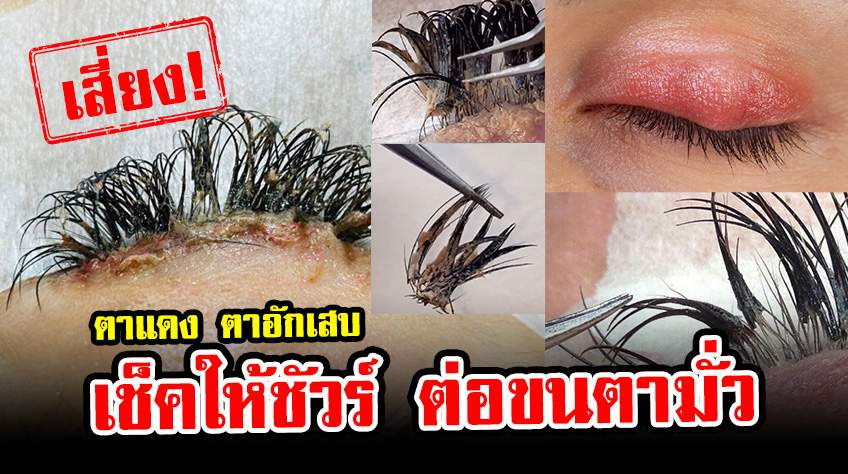 ต่อขนตา ตาแดง ตาอักเสบ เกิดจากอะไร