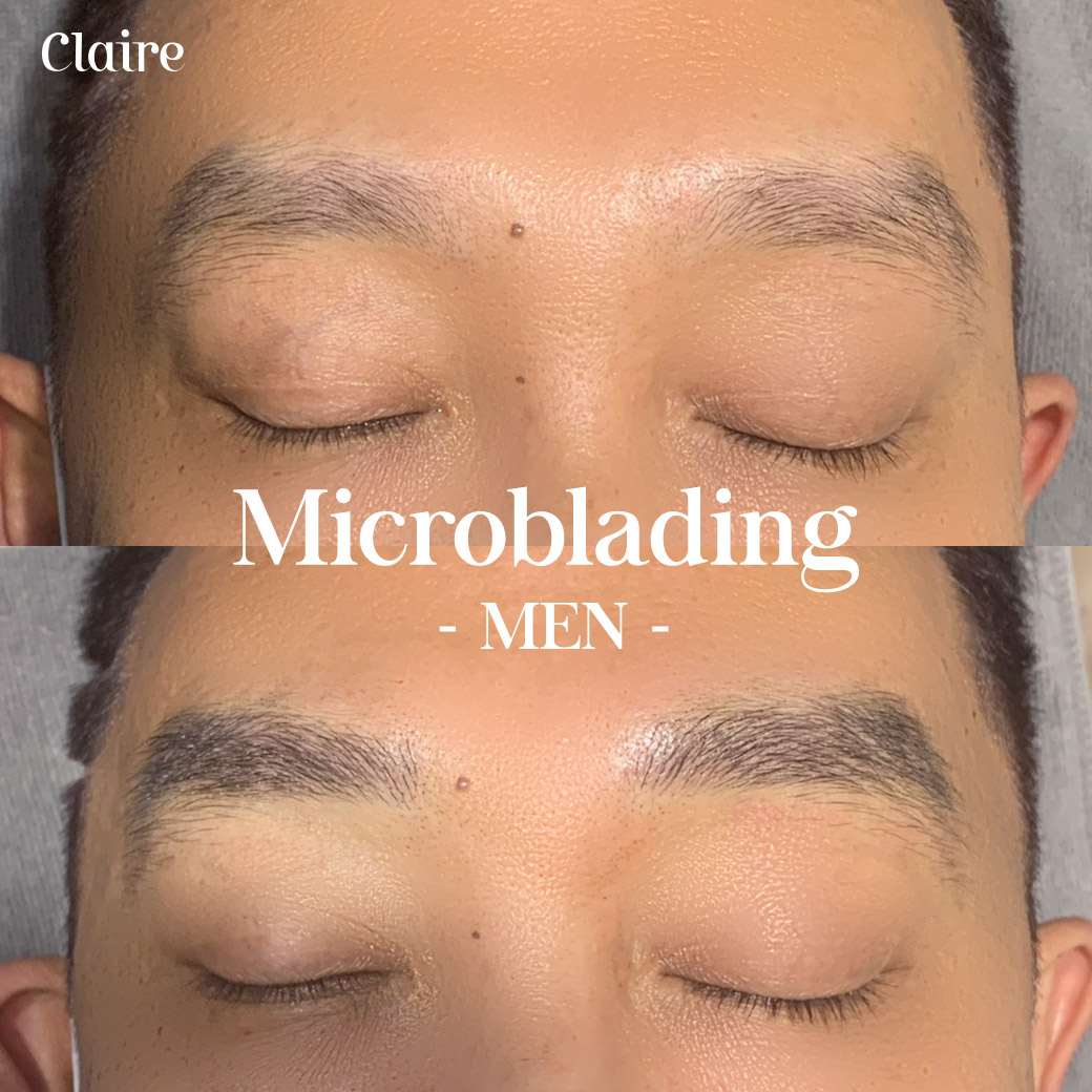 สักคิ้วผู้ชาย,สักคิ้วลายเส้น,สักคิ้วลายเส้น ผู้ชาย,สักคิ้ว microblading,คิ้วผู้ชาย,ฝังสีคิ้วผู้ชาย,รีวิวฝังสีคิ้ว Claire,รีวิวฝังสีคิ้วผู้ชาย,รีวิวสักคิ้วผู้ชาย