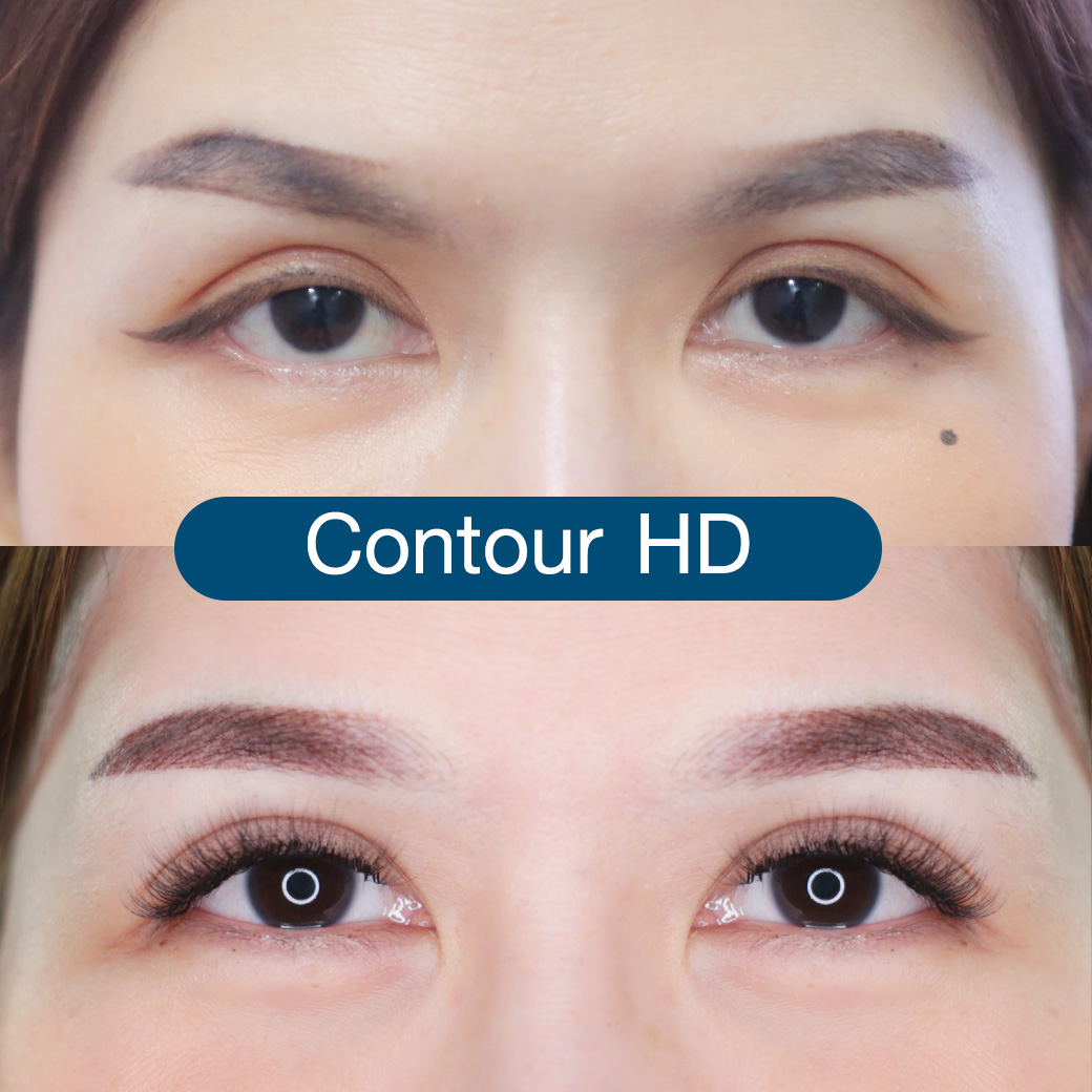 ฝังสีคิ้วแบบContour