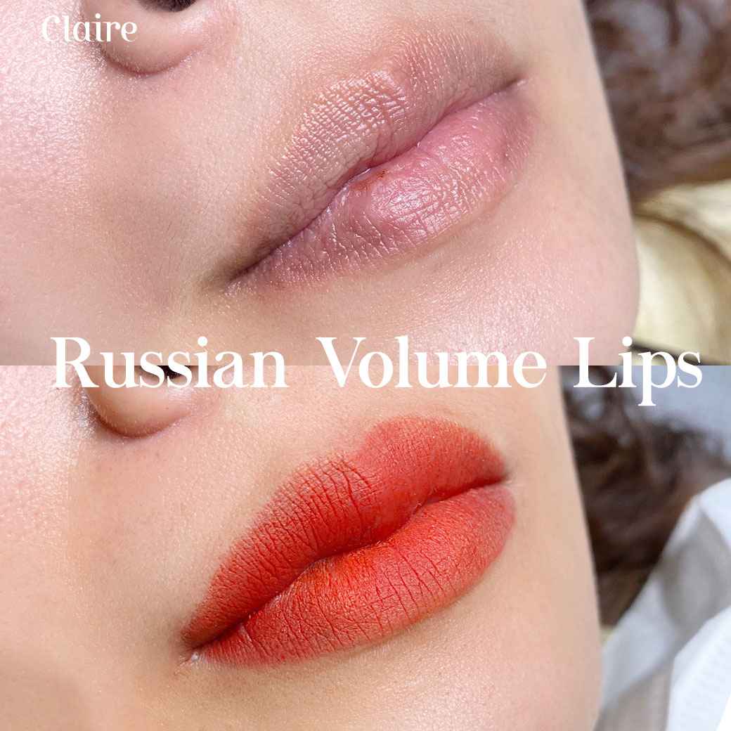 รีวิวฝังสีปาก Claire,รีวิวสักปาก,สักปาก,ฝังสีปาก,ฝังสีปาก Russian Volume Lips