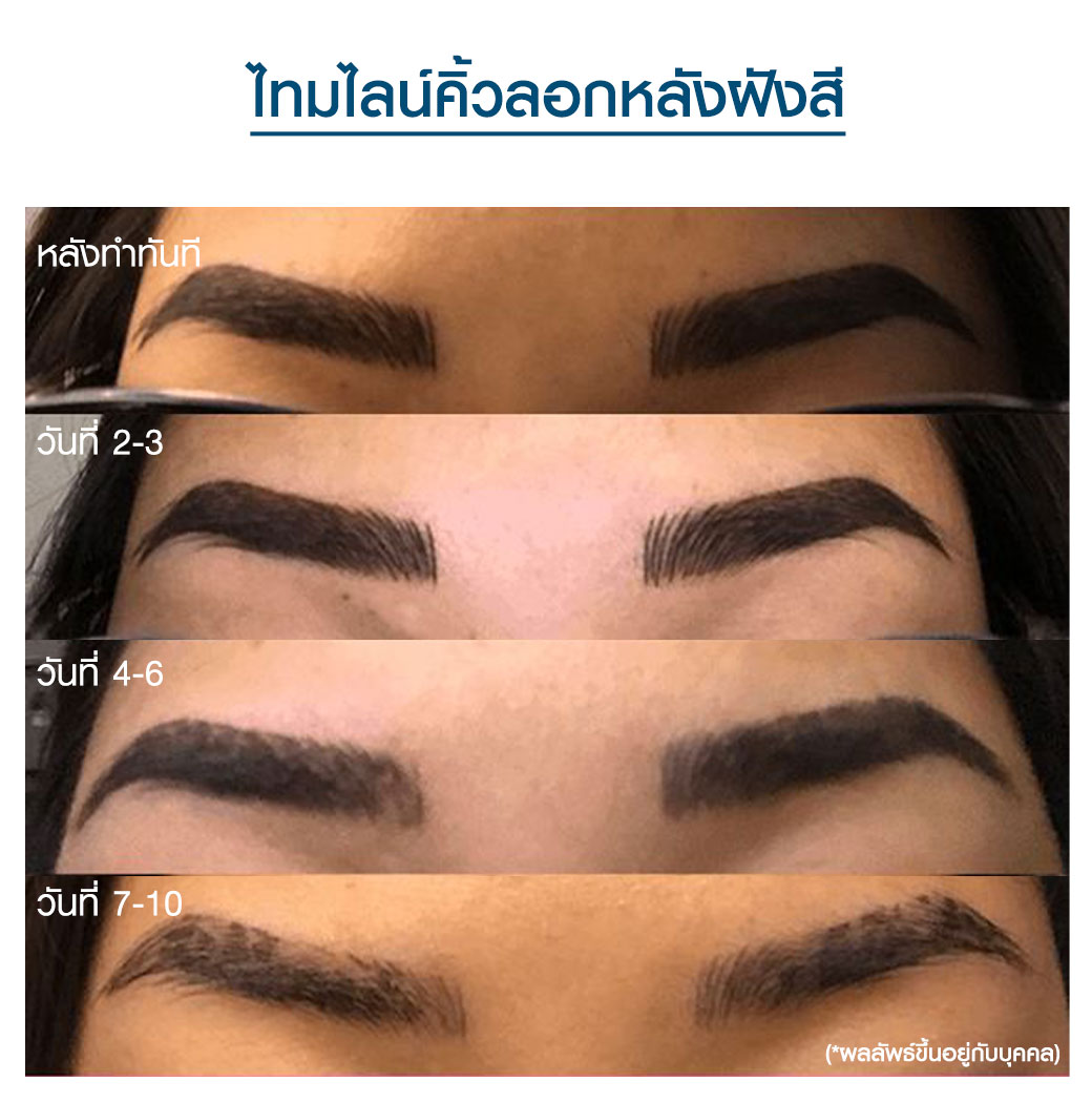 คิ้วลอกแล้วสีจาง