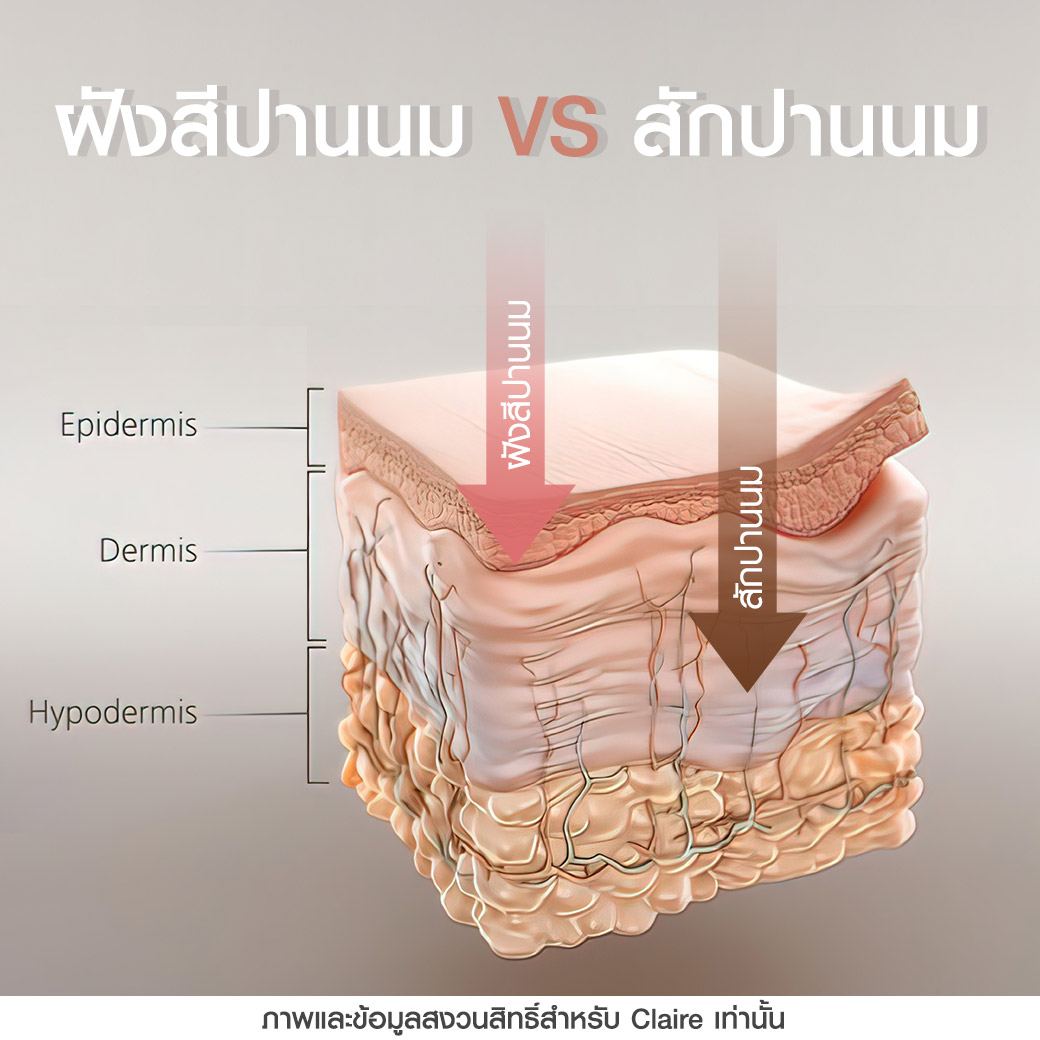 สักปานนม,ฝังสีปานนม,สักหัวนม,ปานนมดำ,รีวิวฝังสีปานนมClaire,รีวิวสักปานนมClaire