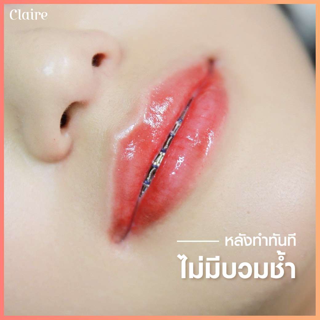 รีวิวสักปาก,สักปาก,รีวิวฝังสีปาก,ฝังสีปาก,สักปากclaire,ฝังสีปากclaire