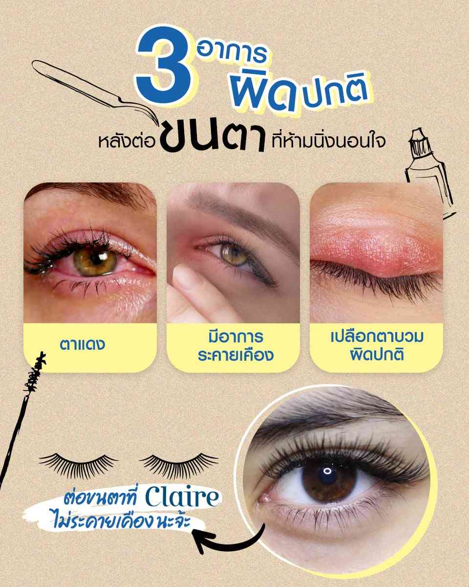 3อาการผิดปกติหลังต่อขนตาที่ต้องรู้