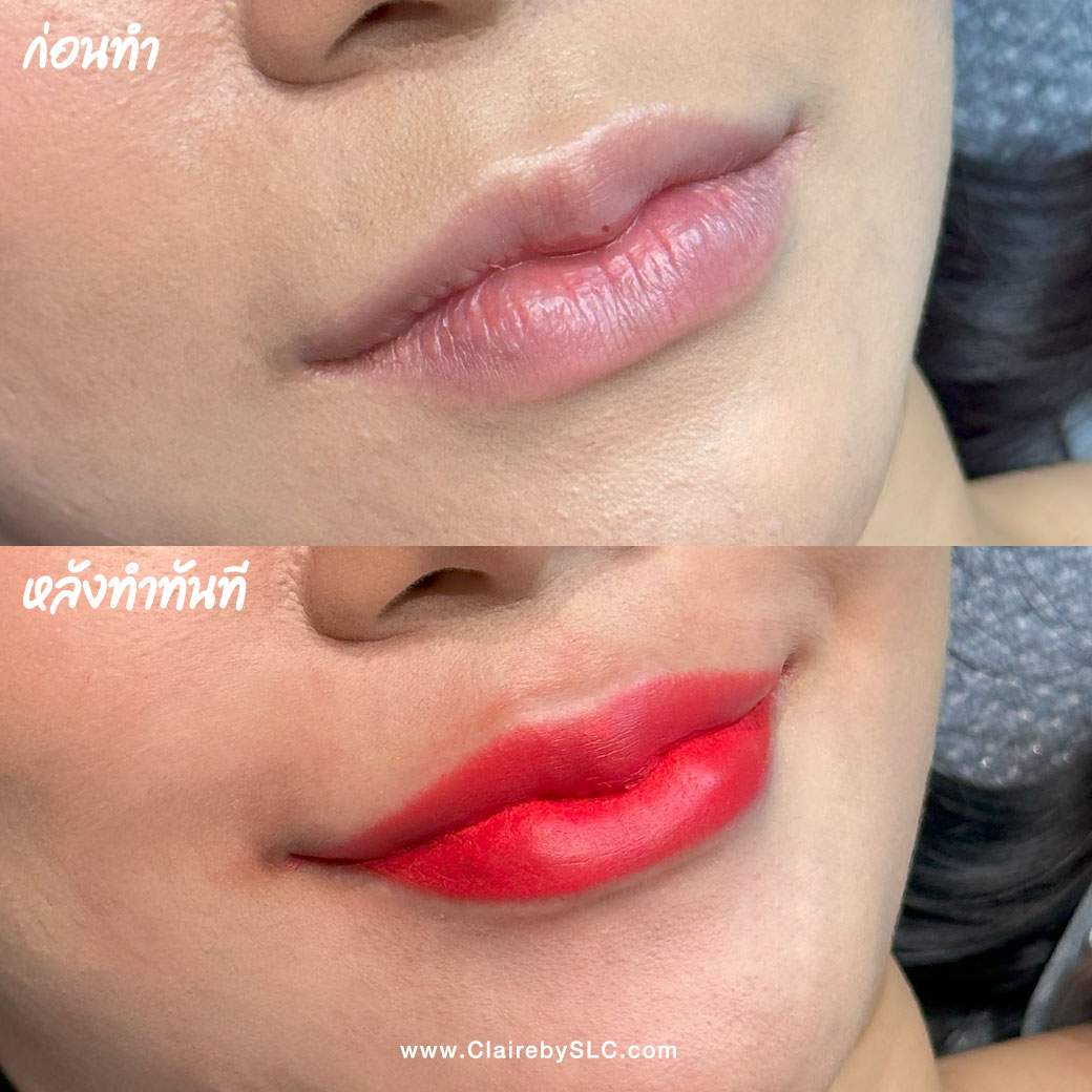 รีวิวฝังสีปาก Claire,รีวิวสักปาก,สักปาก,ฝังสีปาก,ฝังสีปาก Russian Volume Lips