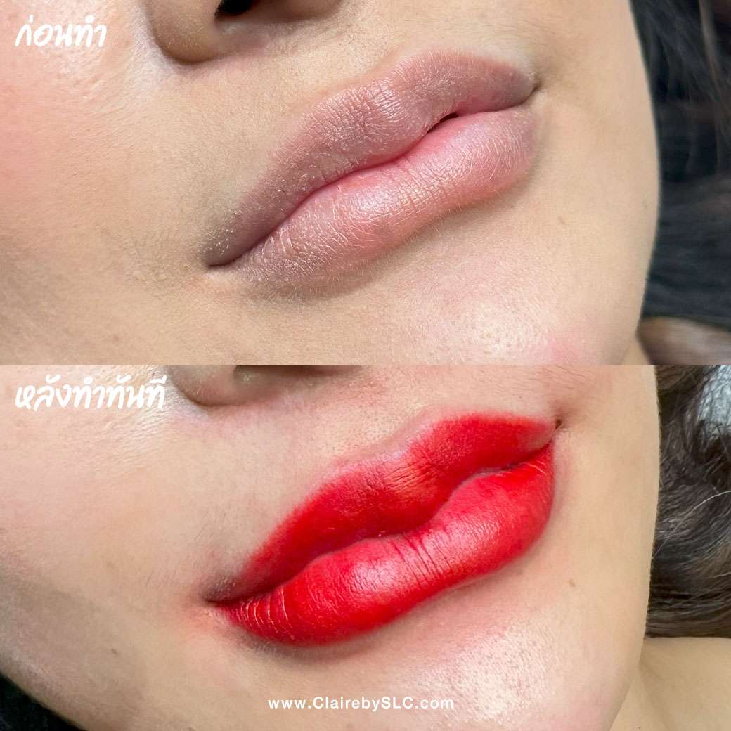 รีวิวฝังสีปาก Claire,รีวิวสักปาก,สักปาก,ฝังสีปาก,ฝังสีปาก Russian Volume Lips