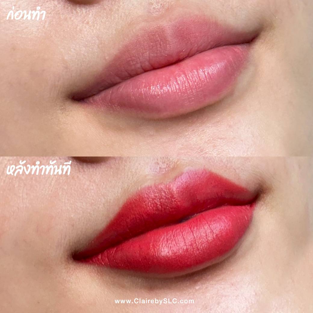 รีวิวฝังสีปาก Claire,รีวิวสักปาก,สักปาก,ฝังสีปาก,ฝังสีปาก Russian Volume Lips