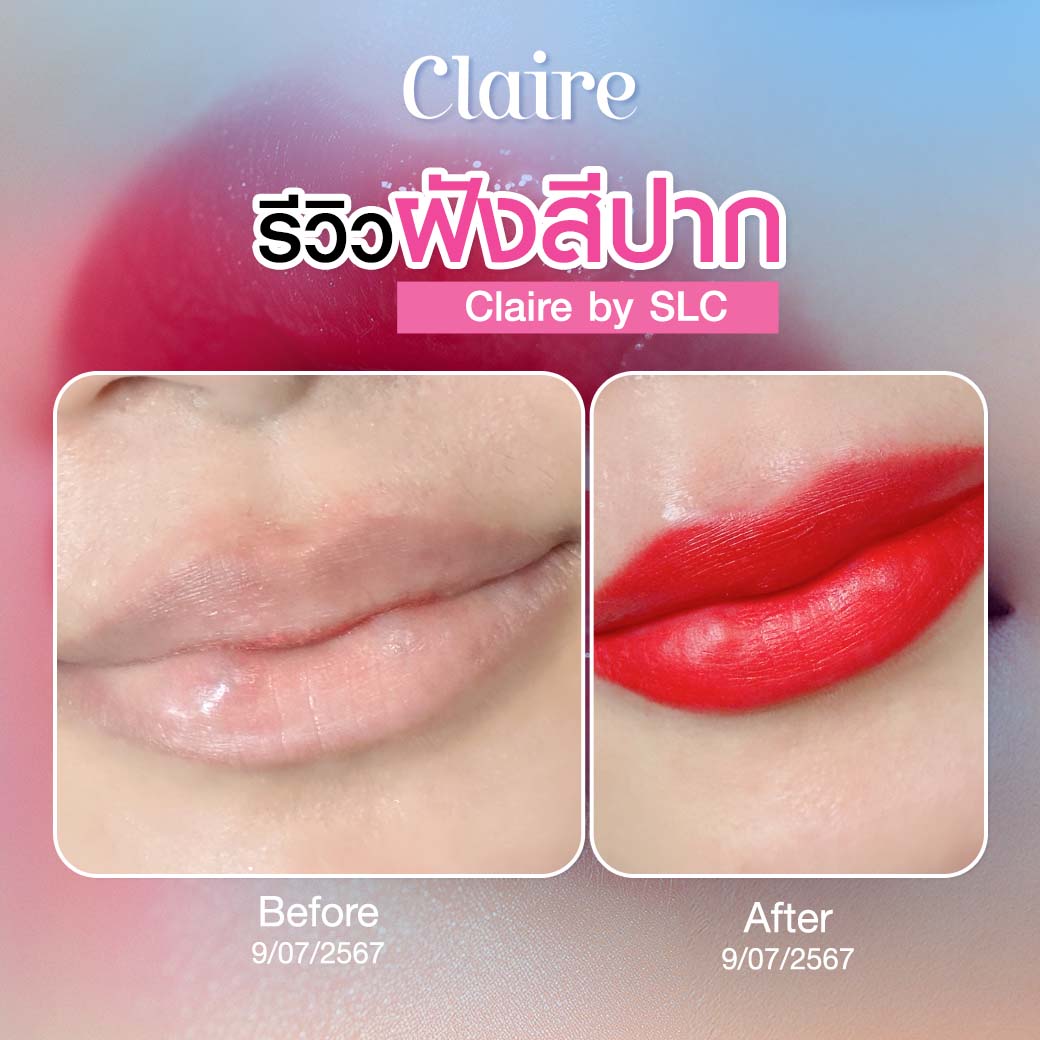 รีวิวฝังสีปาก, ฝังสีปาก Claire, ฝังสีปากที่ไหนดี, ฝังสีปาก วิธีการดูแล, เสี่ยวหยู