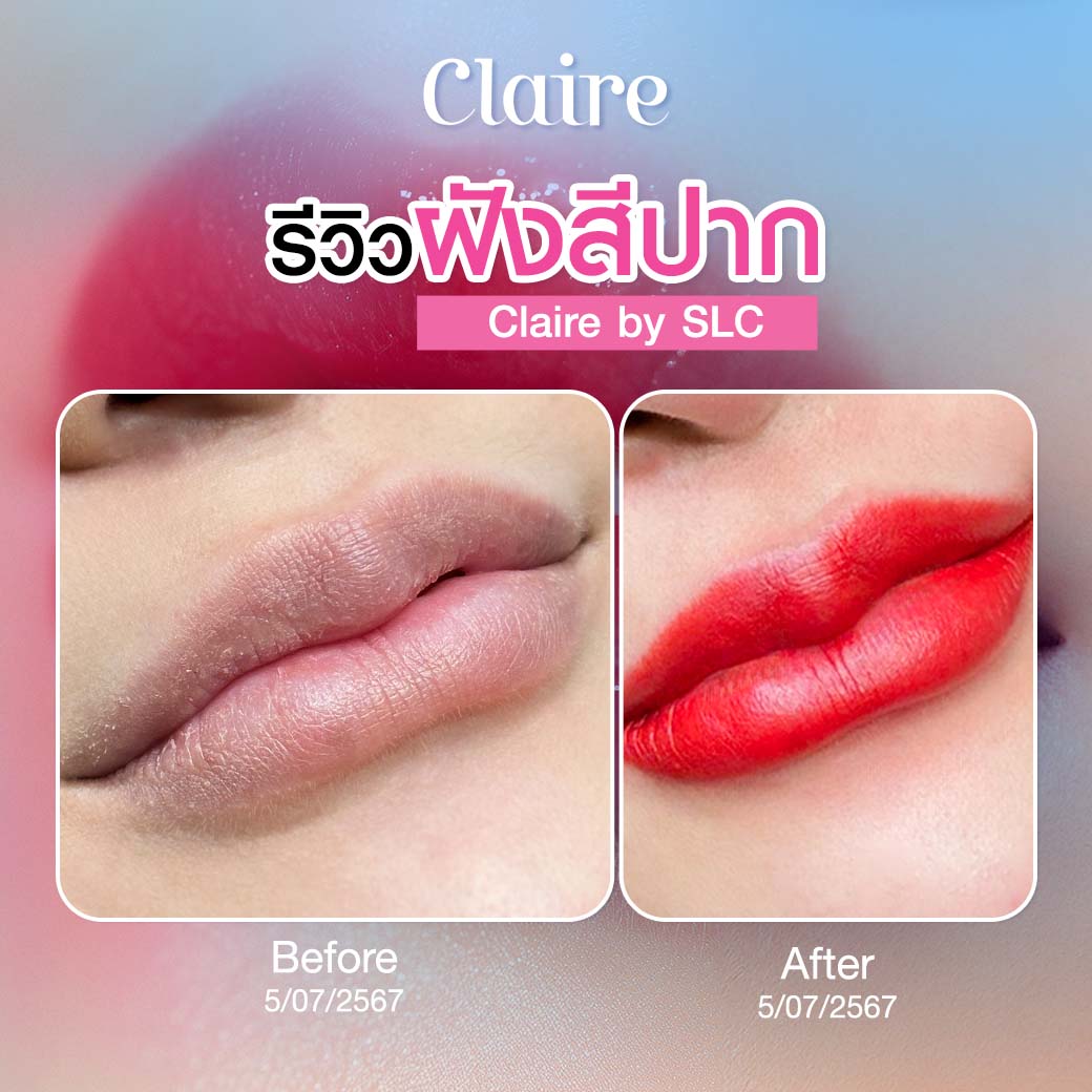 รีวิวฝังสีปาก, ฝังสีปาก Claire, ฝังสีปากที่ไหนดี, ฝังสีปาก วิธีการดูแล, เสี่ยวหยู