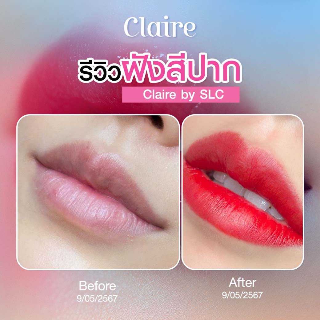 รีวิวฝังสีปาก, ฝังสีปาก Claire, ฝังสีปากที่ไหนดี, ฝังสีปาก วิธีการดูแล, เสี่ยวหยู