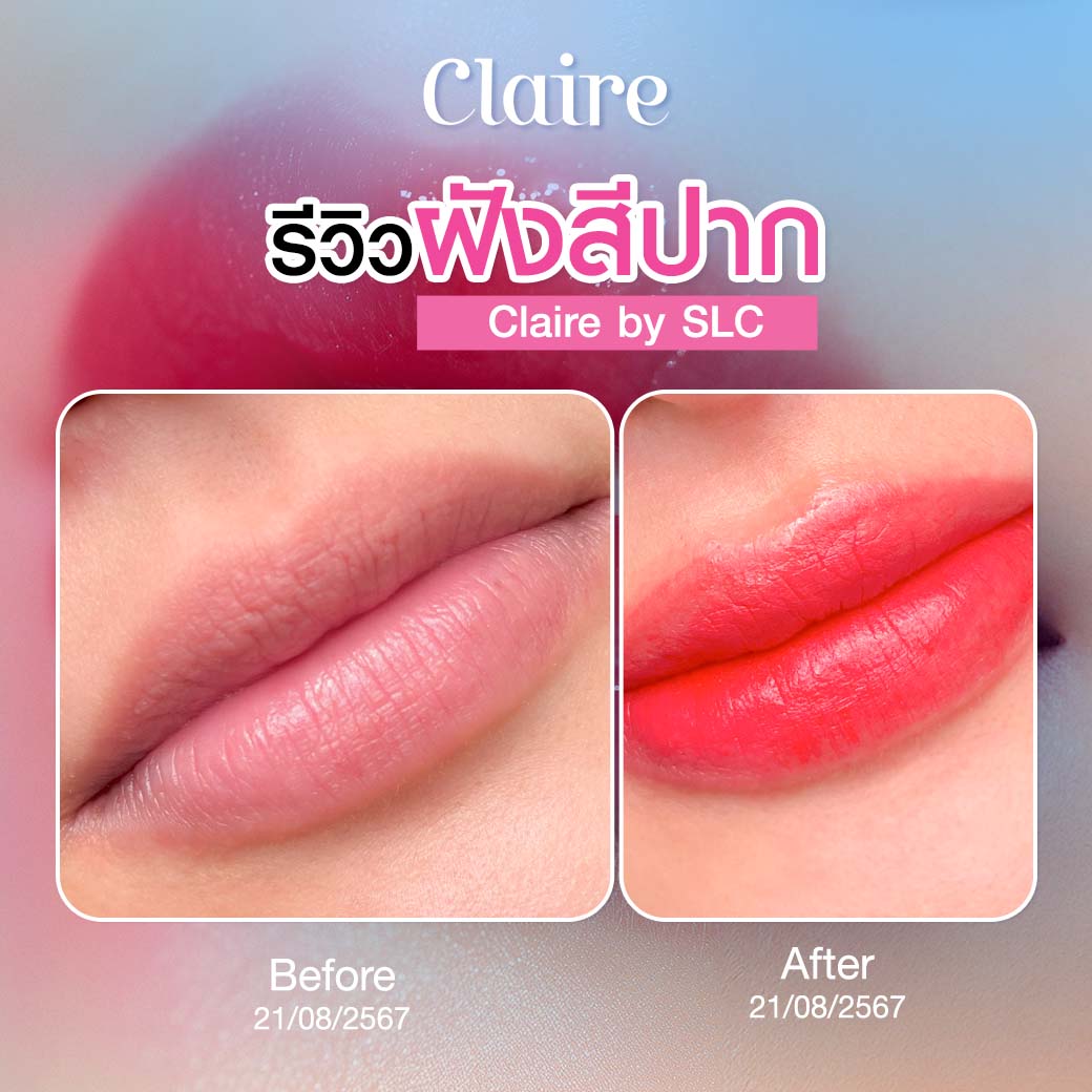 รีวิวฝังสีปาก, ฝังสีปาก Claire, ฝังสีปากที่ไหนดี, ฝังสีปาก วิธีการดูแล, เสี่ยวหยู